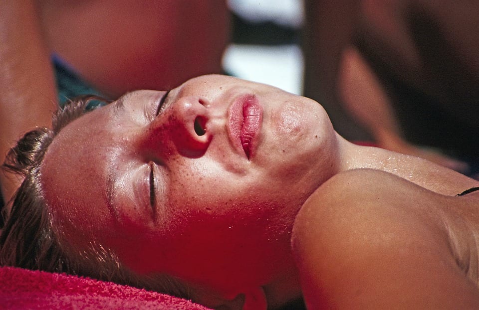 Sunburn Omaha Urgent Care Prevention & When To Seek Treatment