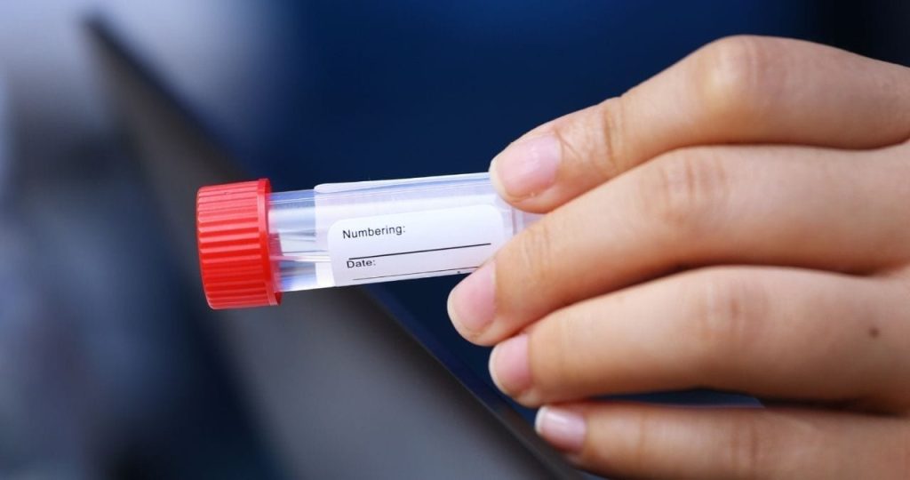 Saliva COVID-19 Tests