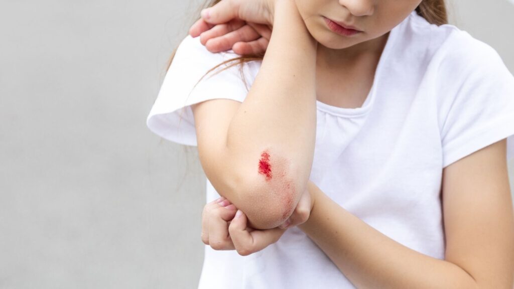 Minor Cuts and Wounds